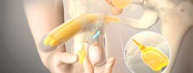 penis protezi, mutluluk çubuğu penis protezi, mutluluk çubuğu